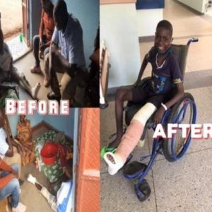 MAFAC INTERVENES TO SAVE A UGANDAN BOY’S LEG